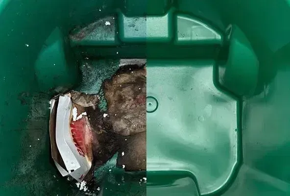 Why Trash Bin Cleaning Matters